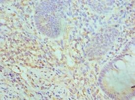 Polyclonal Rabbit anti-Human SMARCC2 Antibody (aa300-650, IHC, WB)