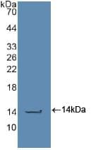 CASP2 / Caspase 2 Antibody (aa170-325)