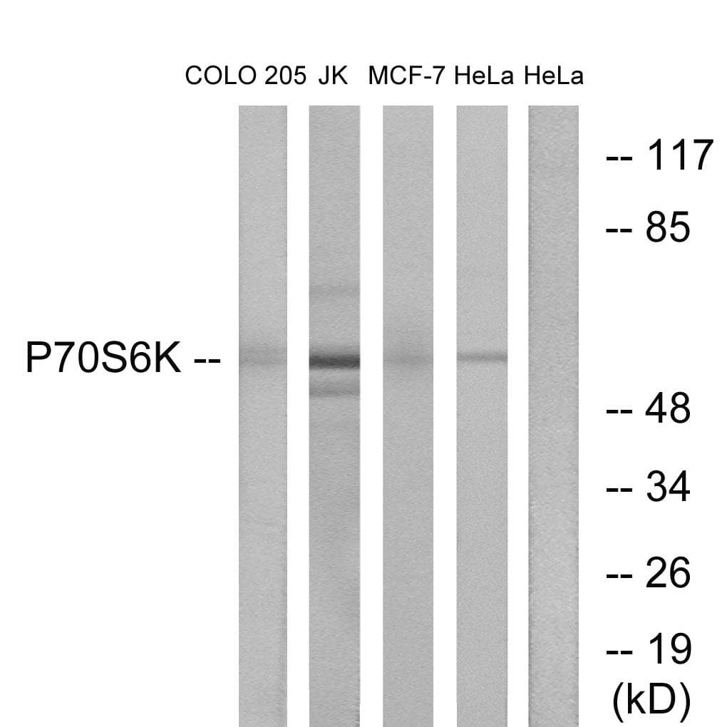 Polyclonal Rabbit anti-Human RPS6KB1 / P70S6K / S6K Antibody (p418, IHC, WB)