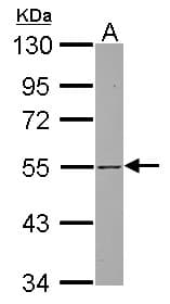 Polyclonal Rabbit anti-Human SH3BP5 / SAB Antibody (WB)