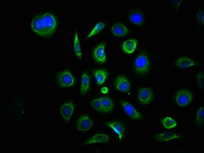 MAP3K7CL / TAK1L Antibody (aa1-142)