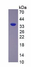 Rat ARG1 / Arginase 1 Protein (Recombinant His, N-Terminal)