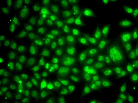 TBL1XR1 / TBLR1 Antibody