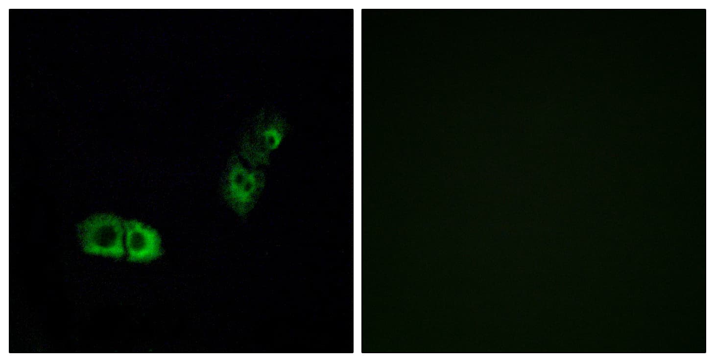 BRS3 Antibody (aa161-210)