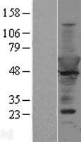 Human CPNE6 / N-COPINE Protein (Over-Expression Lysate Myc-DDK (Flag))