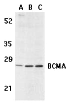 TNFRSF17 / BCMA Antibody
