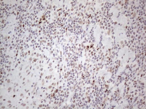 TP53BP1 / 53BP1 Antibody (aa1-300, clone OTI5E1)