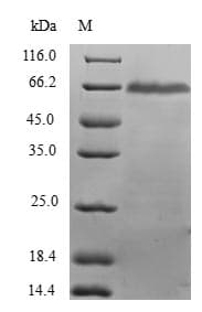 Human HDS / DHDDS Protein (Recombinant GST, N-terminus)