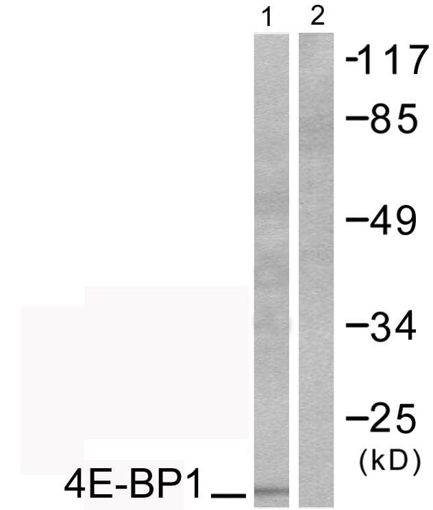 EIF4EBP1 / 4EBP1 Antibody (p69)