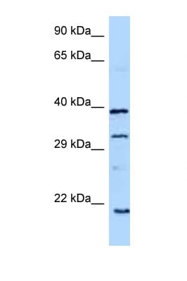 Polyclonal Rabbit anti-Human GH / Growth Hormone Antibody (C-Terminus, WB)