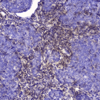 TLN1 / Talin 1 Antibody