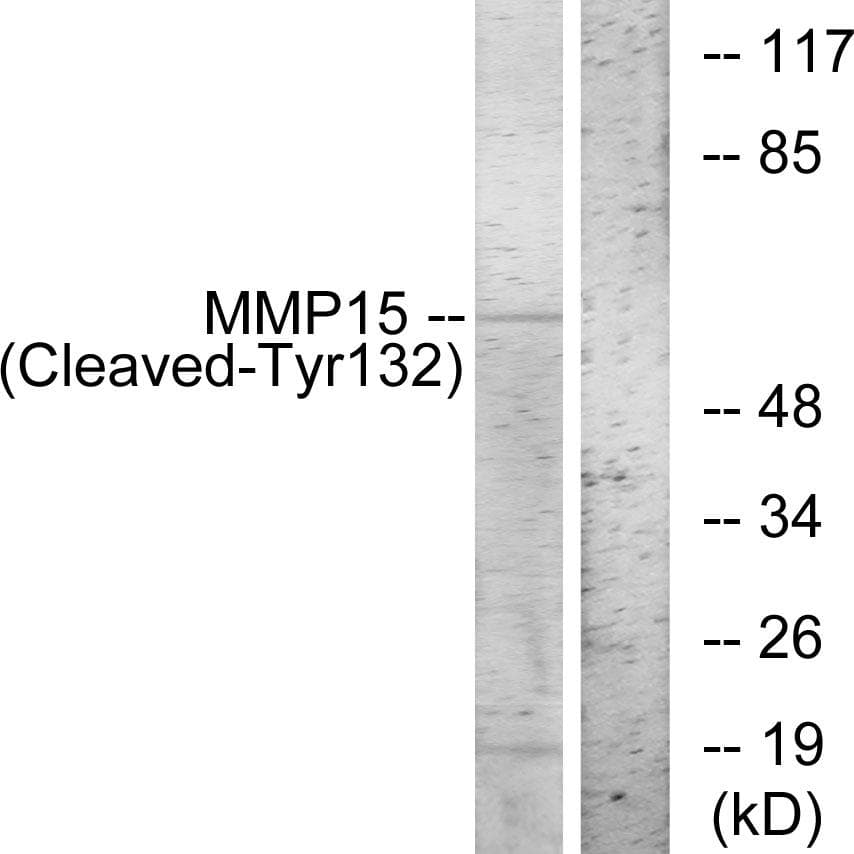 MMP15 Antibody (Cleaved-Tyr132)