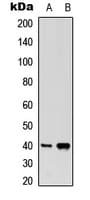 IHC-plus™ Prostaglandin D2 Receptor Antibody (C-Terminus)