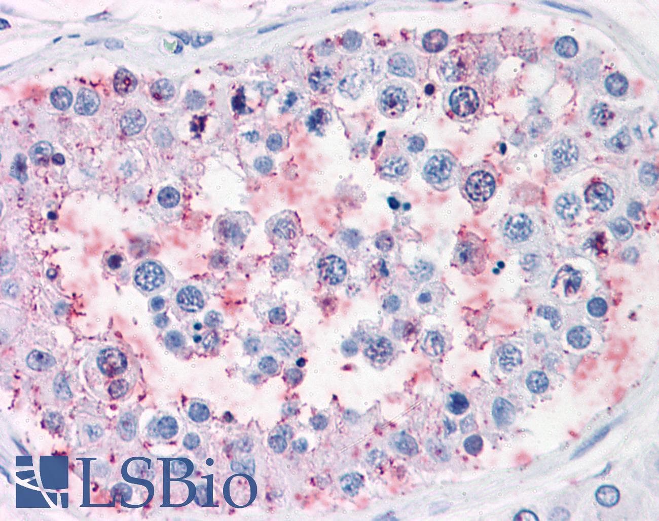 IHC-plus™ Polyclonal Rabbit anti-Human ENPP3 / CD203c Antibody (Internal, IHC)