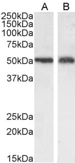 PathPlus™ SLC7A11 / XCT Antibody (aa215-229)