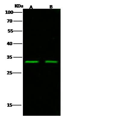 IL1RL1 Antibody (Preservative Free)
