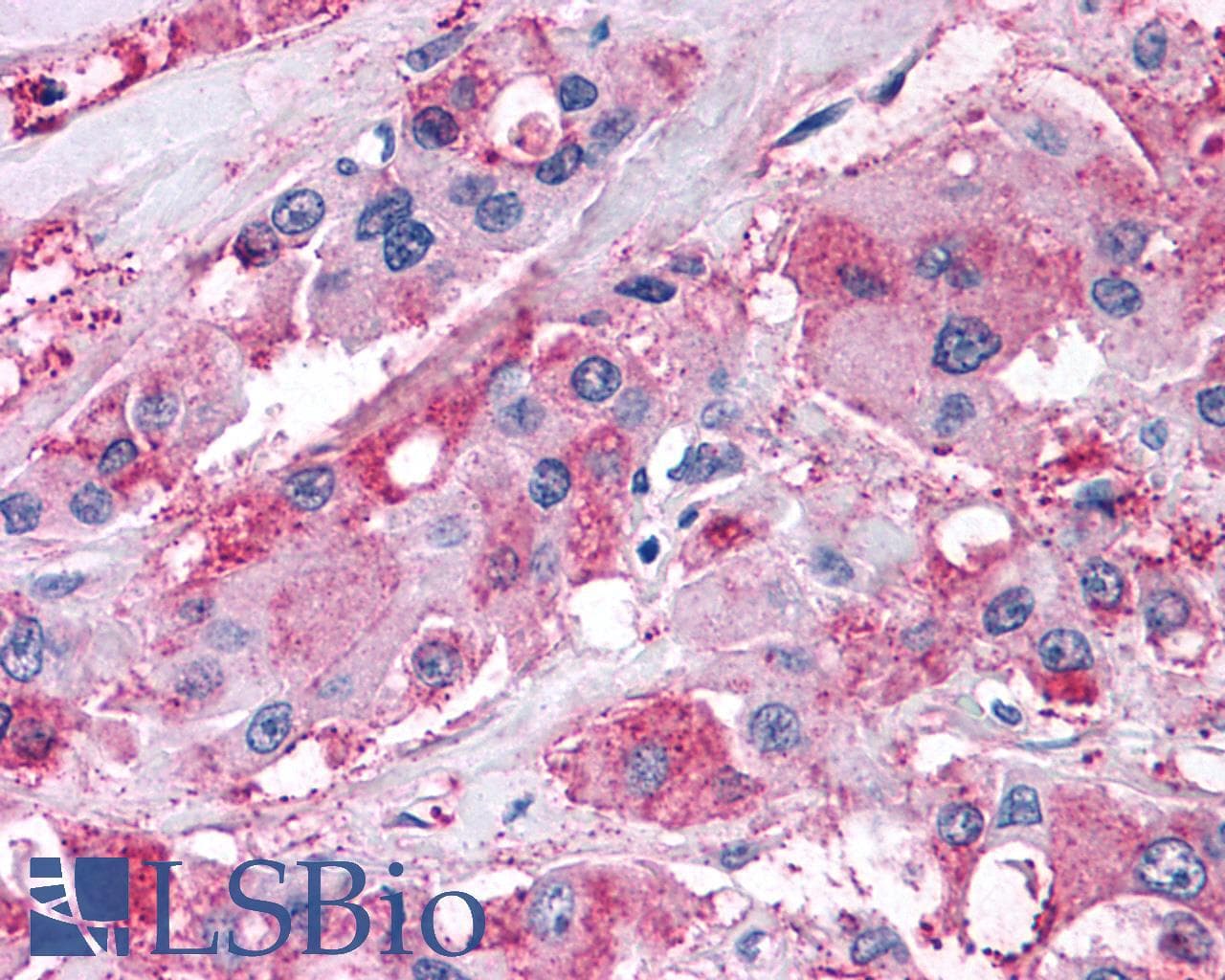 PathPlus™ NPY5R Antibody (Cytoplasmic Domain)