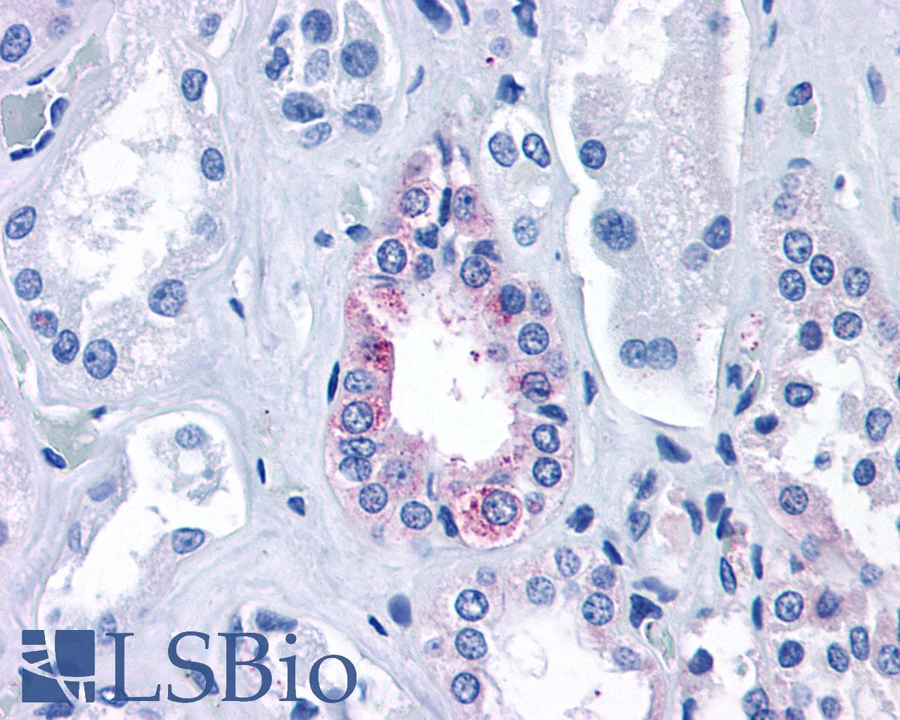 PathPlus™ Polyclonal Rabbit anti-Human CASR/Calcium Sensing Receptor Antibody (N-Terminus, IHC)