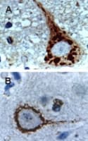 CASP9 / Caspase 9 Antibody