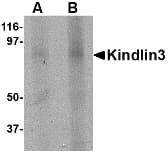 IHC-plus™ URP2 / FERMT3 Antibody