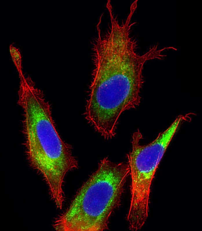 TF / Transferrin Antibody