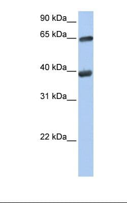 Polyclonal Rabbit anti-Human TKT / Transketolase Antibody (HRP, N-Terminus, WB)