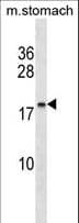 Polyclonal Rabbit anti-Human C9orf7 Antibody (aa123-151, WB)