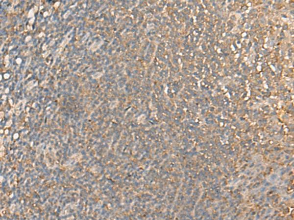 C14orf159 Antibody