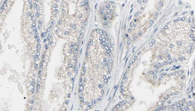RHOA Antibody