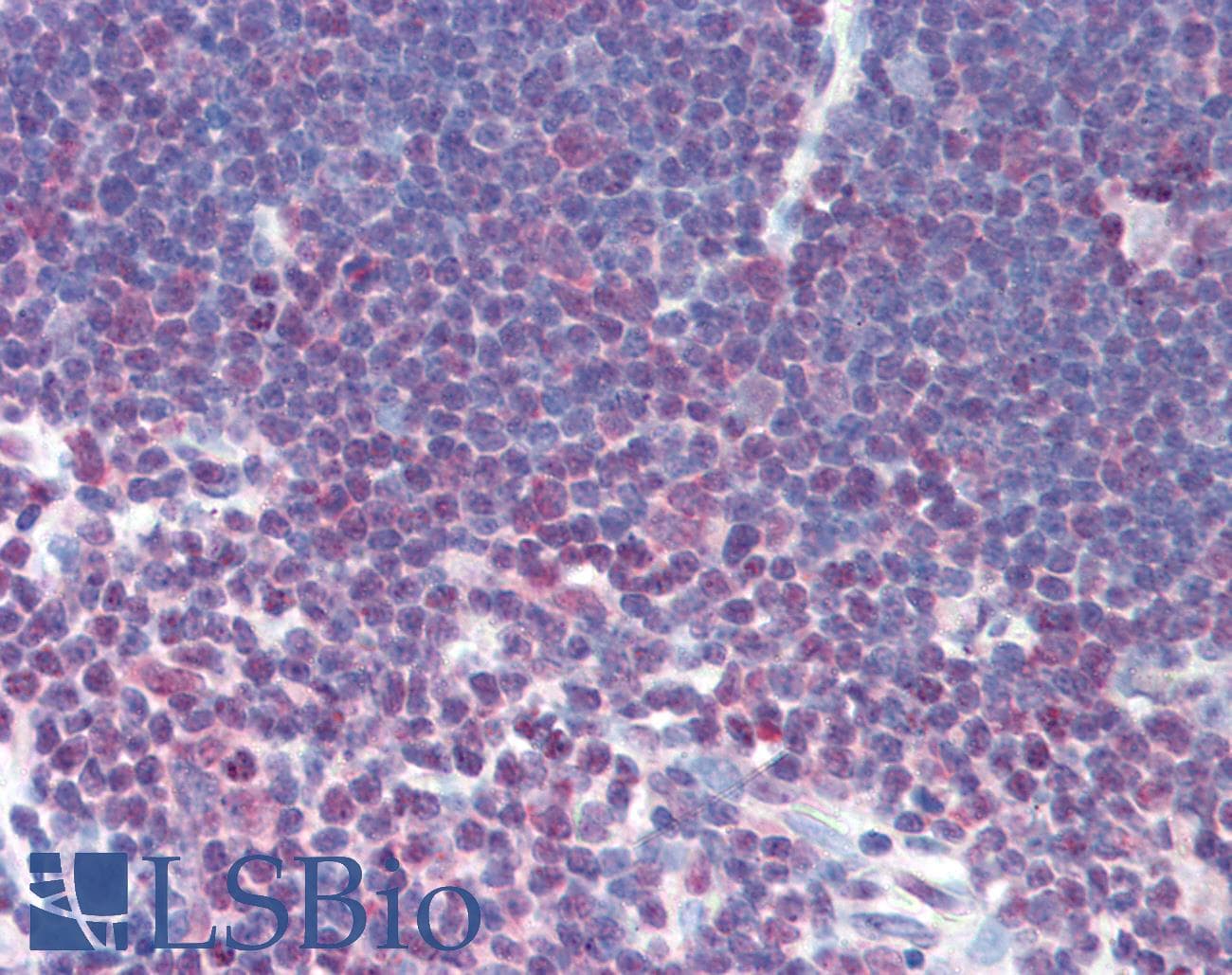 IHC-plus™ Polyclonal Rabbit anti-Human NFATC1 / NFAT2 Antibody (aa263-282, IHC, WB)