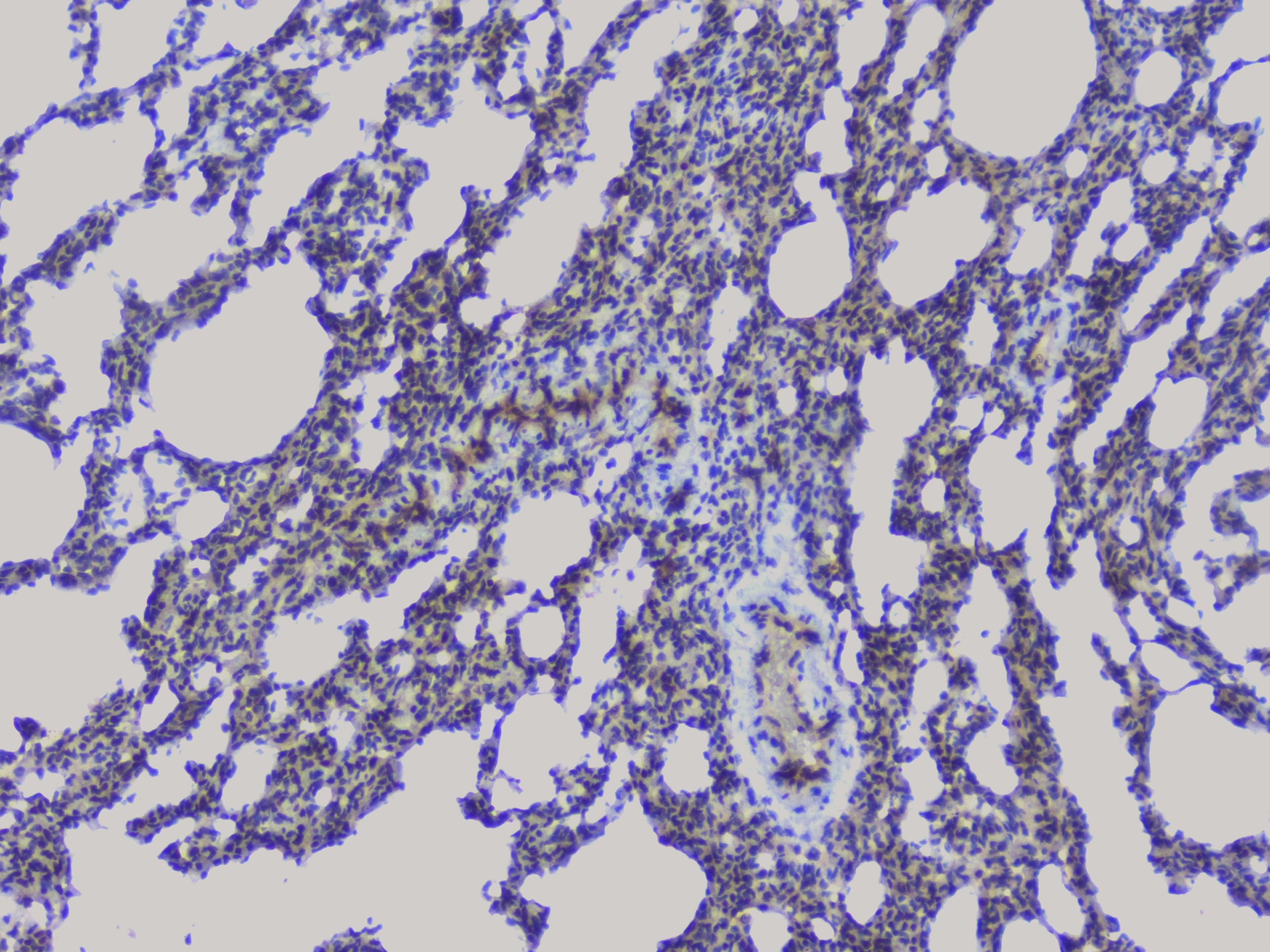 NRF1 / NRF-1 Antibody