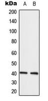 LPAR3 / LPA3 / EDG7 Antibody (Internal)