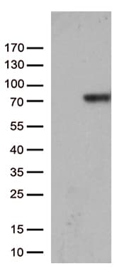 F2 / Prothrombin / Thrombin Antibody (aa44-622, clone OTI5B11, Carrier-free)