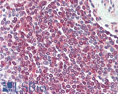 IHC-plus™ DPP4 / CD26 Antibody