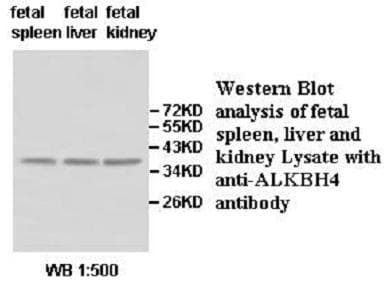 Polyclonal Rabbit anti-Human ALKBH4 Antibody (aa38-282, IHC, WB)