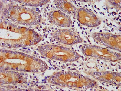 HEDLS / EDC4 Antibody