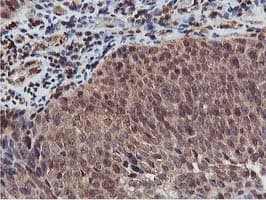 AKT1 Antibody (clone OTI3B4, Carrier-free)