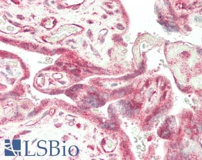 Polyclonal Rabbit anti-Human FURIN Antibody (aa385-500, IHC, WB)