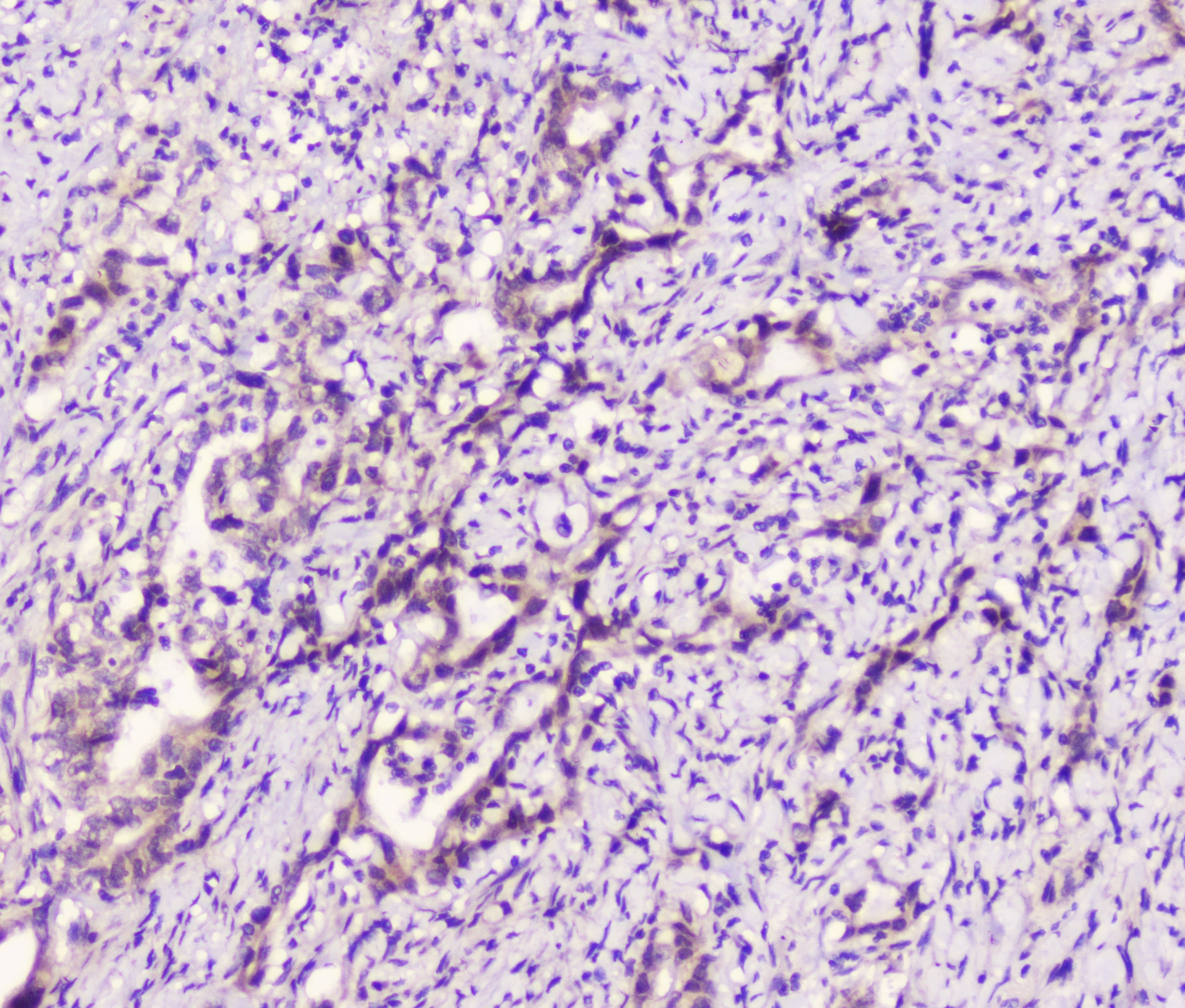 LATS1 Antibody