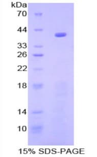 Mouse NFKB1 / NF-Kappa-B Protein (Recombinant His-T7)