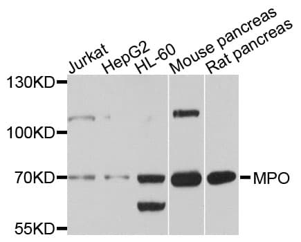 MPO / Myeloperoxidase Antibody