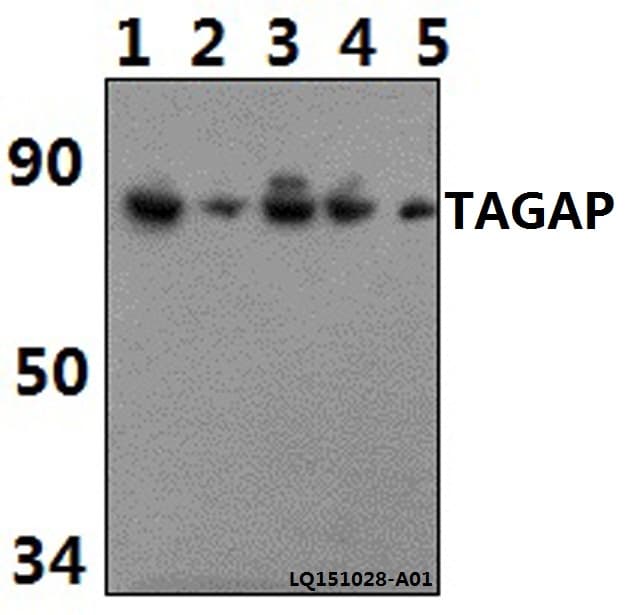 Polyclonal Rabbit anti-Human TAGAP Antibody (WB)