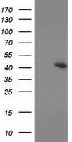 PRKAR1B Antibody (clone OTI12E5)