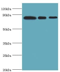 Polyclonal Rabbit anti-Human XRCC5 / Ku80 Antibody (aa543-732, IHC, WB)
