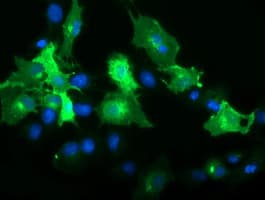 FCGR1A / CD64 Antibody (clone OTI1A9)