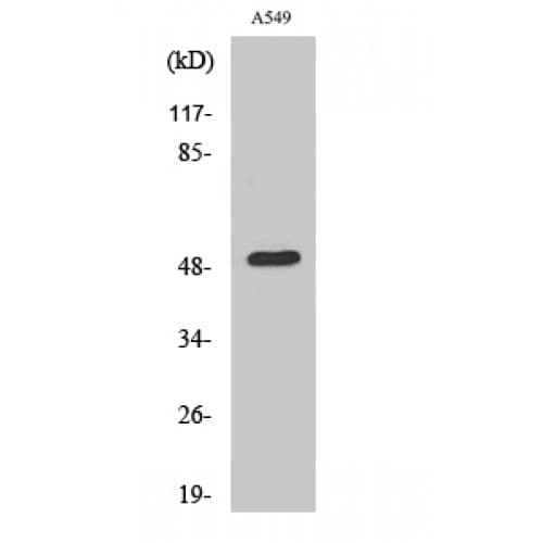 Dynactin 2 / Dynamitin Antibody (310-390 aa, C-terminal)