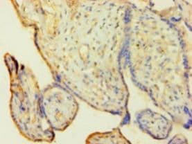 HNRNPH1 / hnRNP H Antibody (aa2-449)
