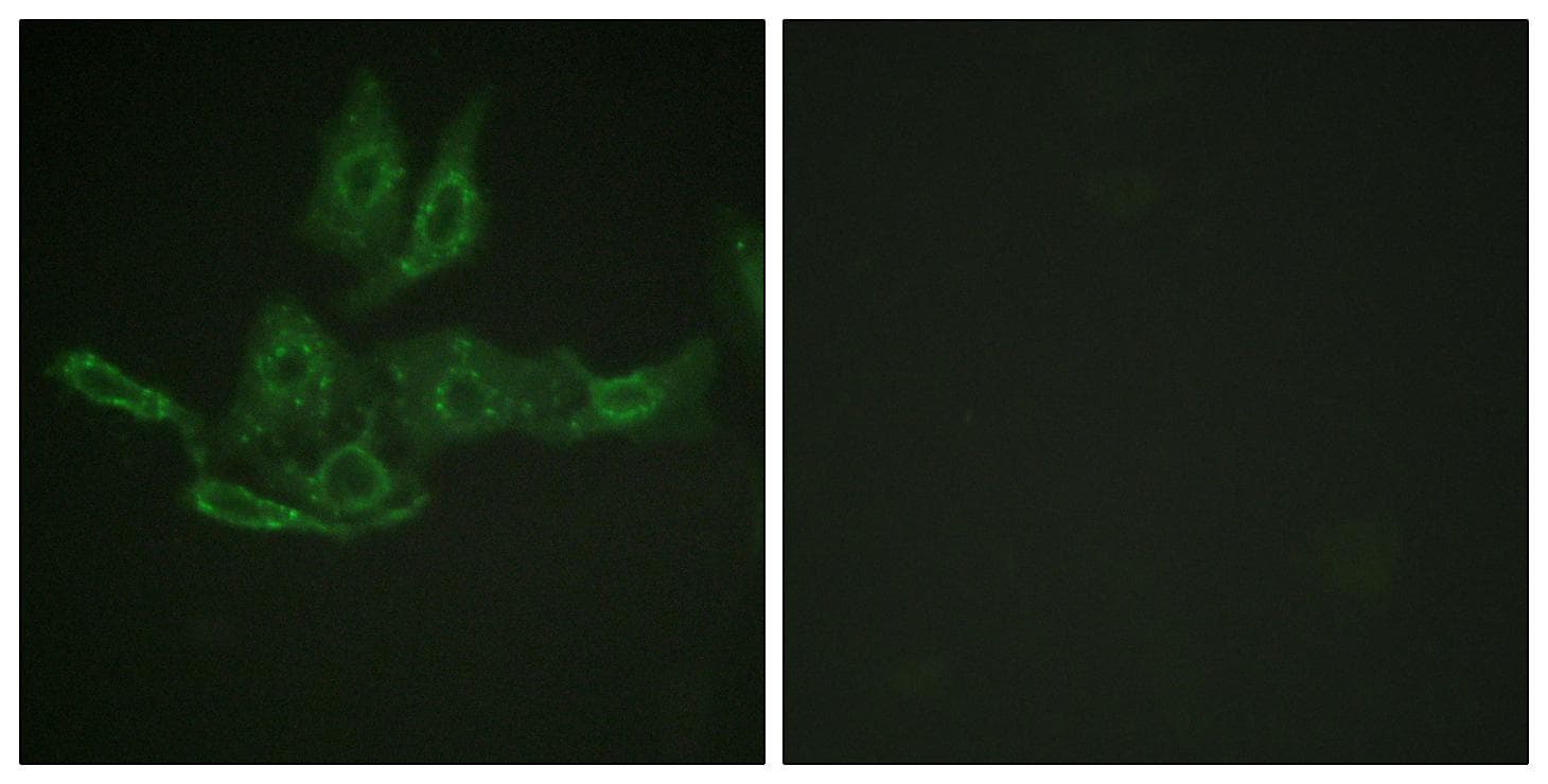 Polyclonal Rabbit anti-Human BCL2 / Bcl-2 Antibody (p69, IHC, IF, WB)