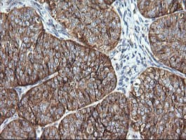 VTI1A Antibody (clone OTI1F4)