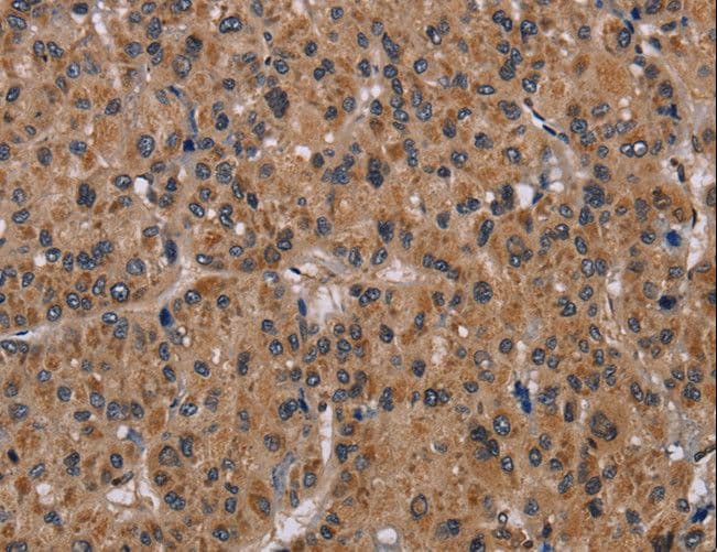 Rhodopsin Kinase / GRK1 Antibody